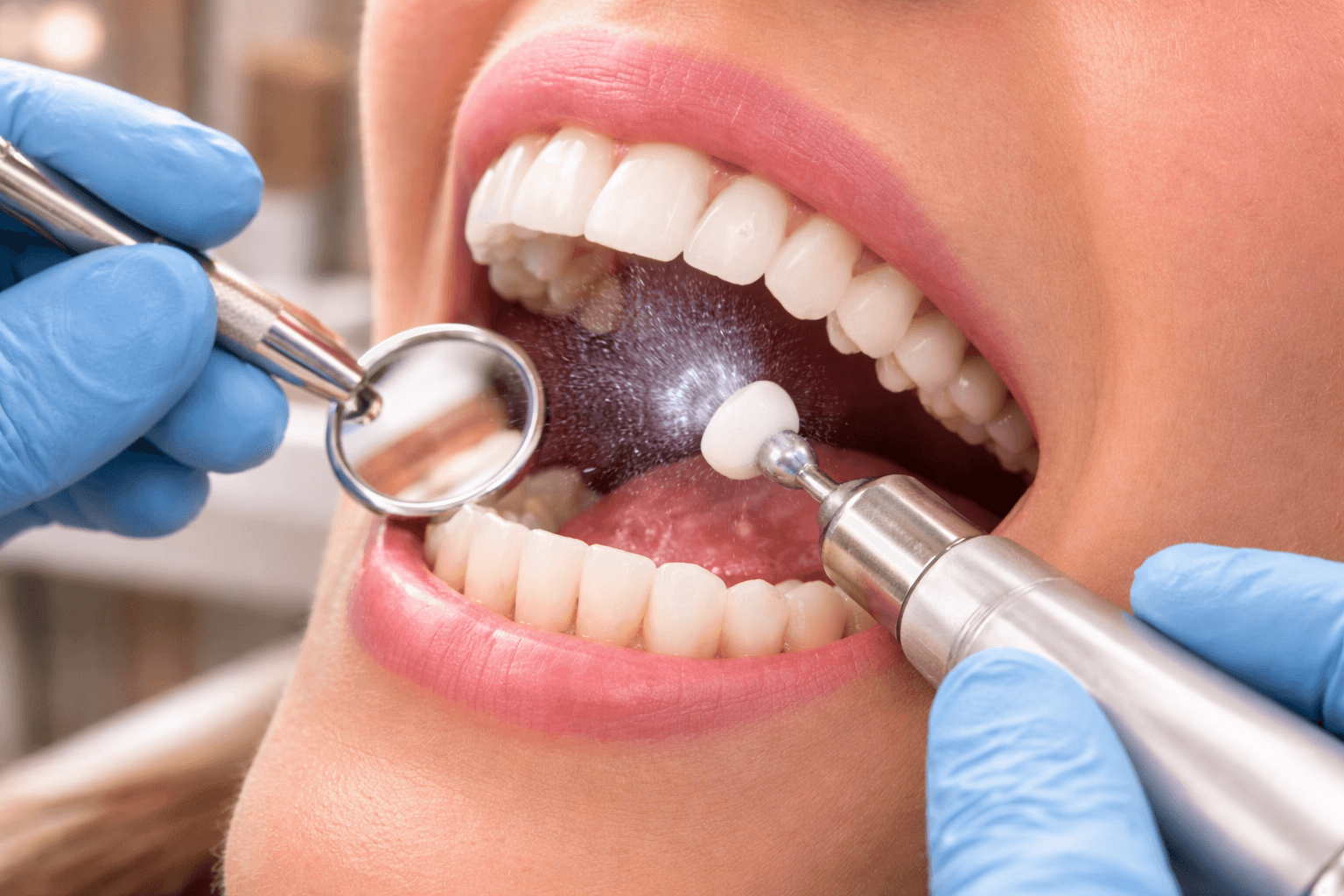 Examen de prévention dentaire